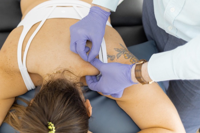 Trigger point dry needling treatment in Roxboro, NC
